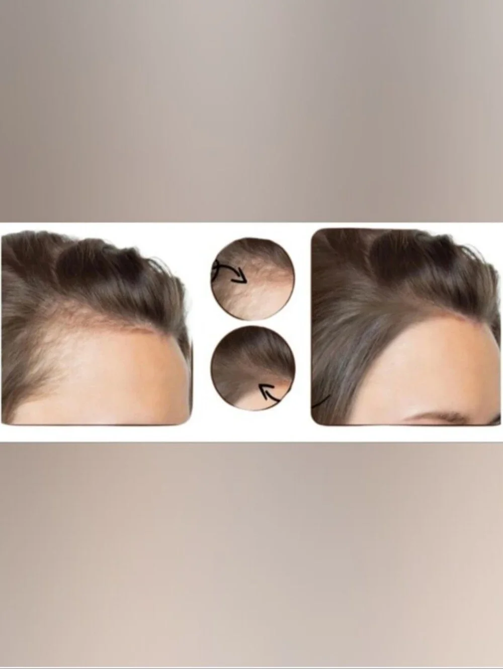 Batana Oil 100% Honduran Miracle Oil - Brown Nourishing Hair Treatment